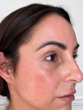 Real patient after
