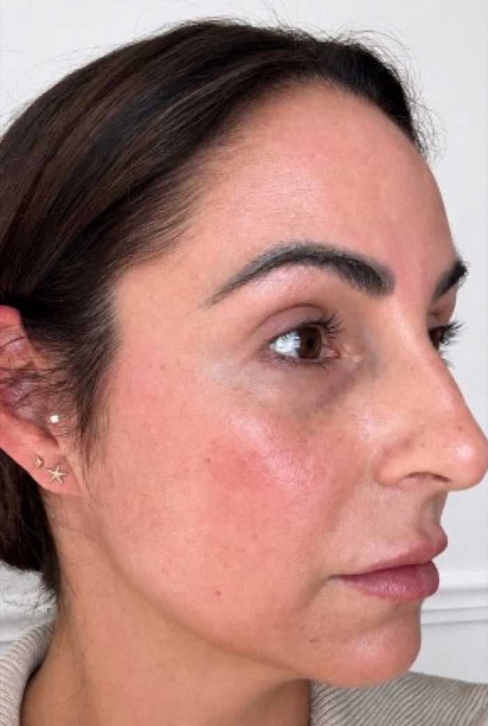 Real patient after