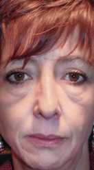 woman with eye festoon
