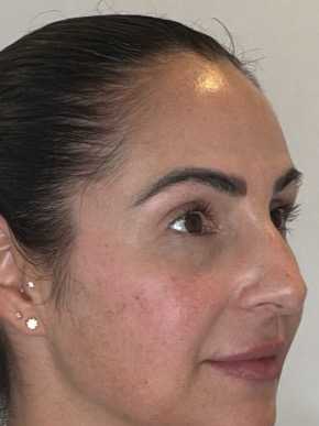 Real patient before