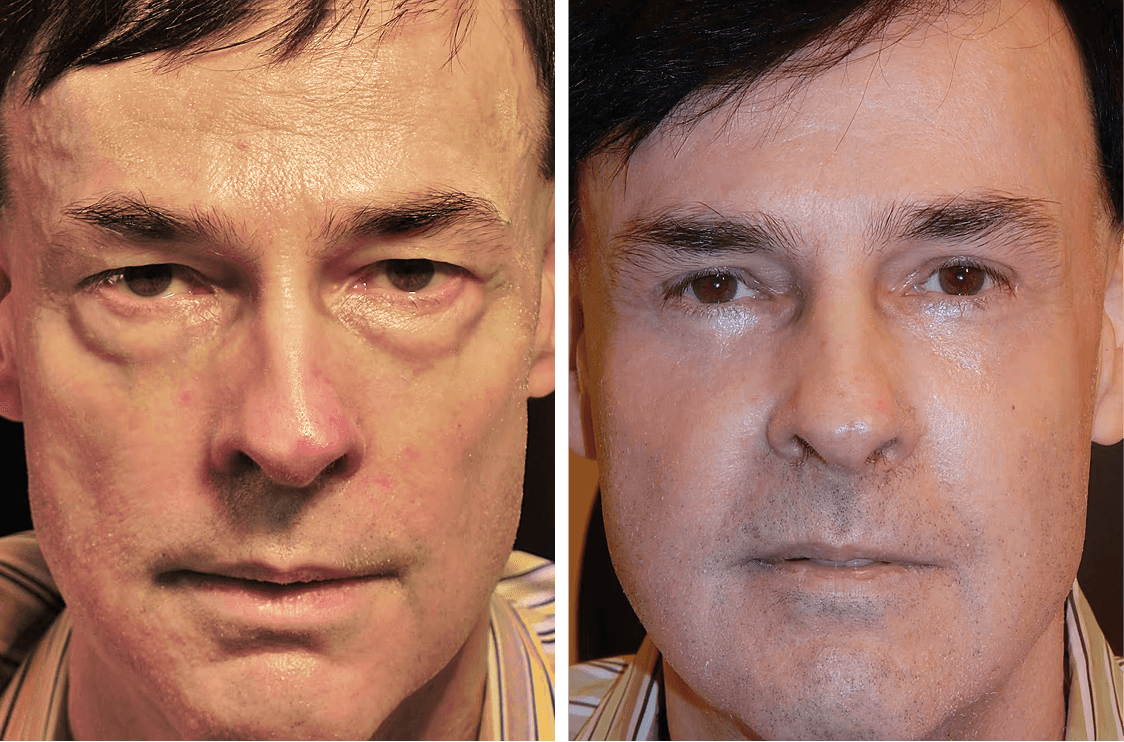 David before and after