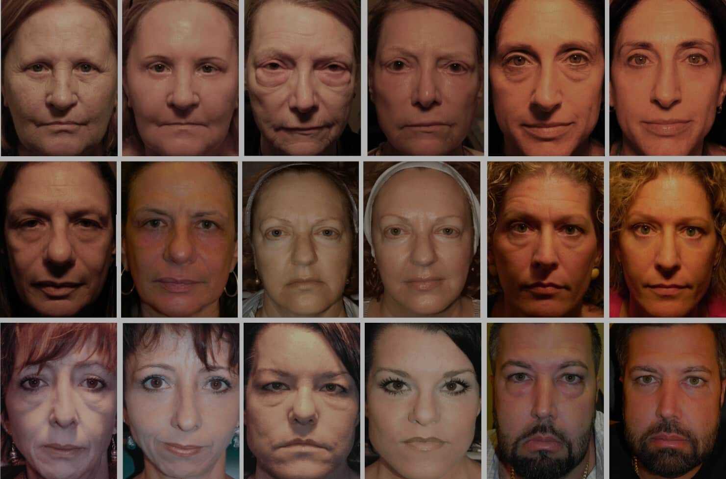 A series of before and after faces that were transformed by Dr Scheiner.
