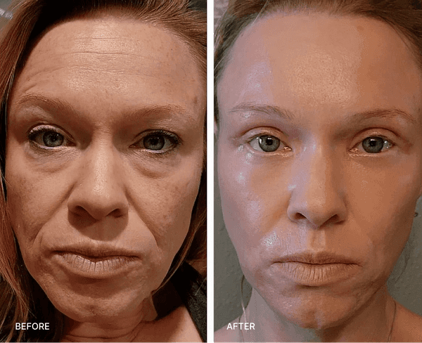 Angie Before and After