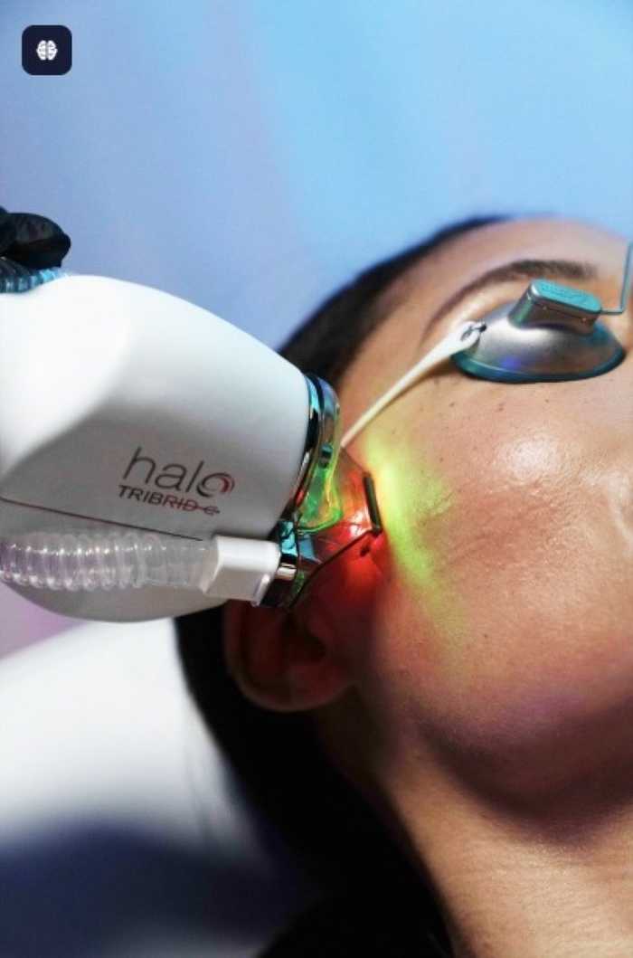 HALO TRIBRID™ treatment