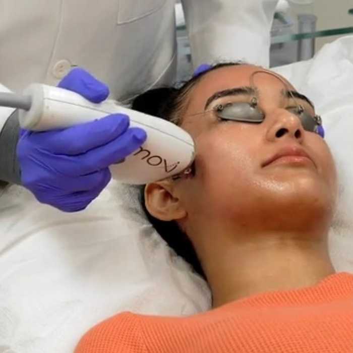 MOXI™ treatment