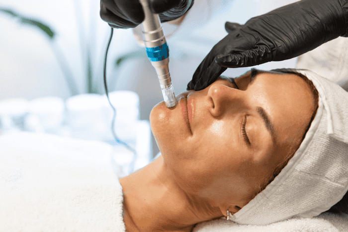 Microneedling with Skin Boosters