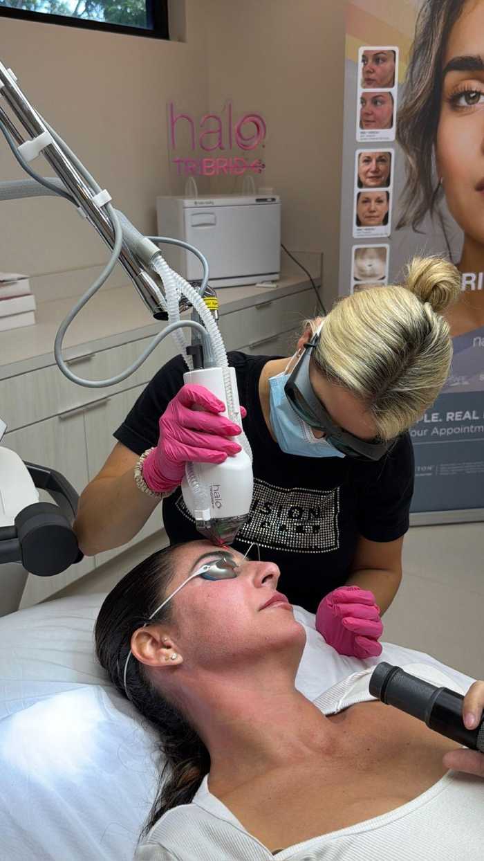 HALO TRIBRID treatment in progress