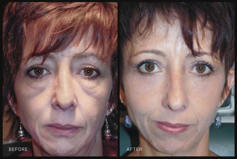 Before and after image of patient.