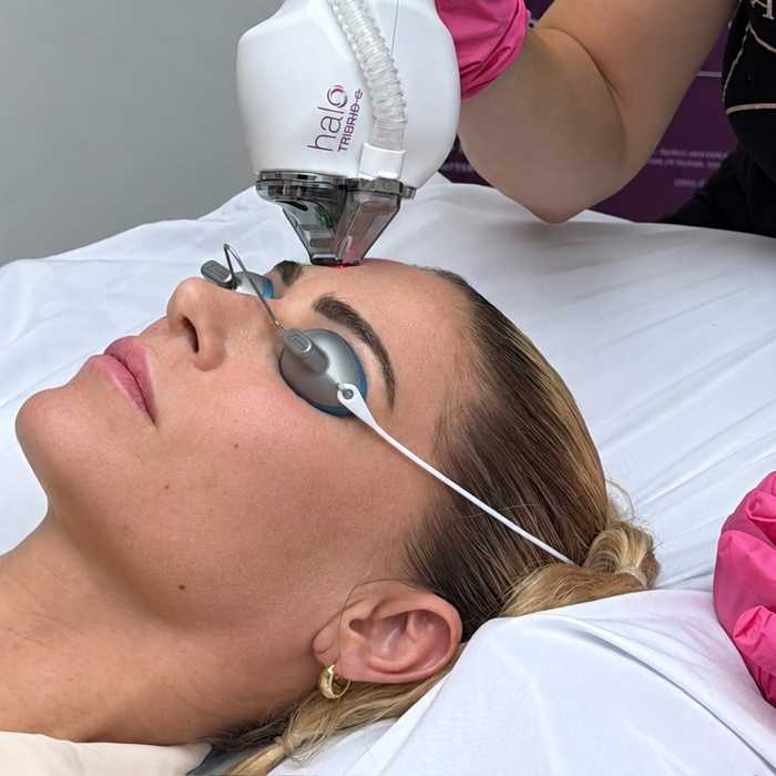 Super MOXI™ treatment