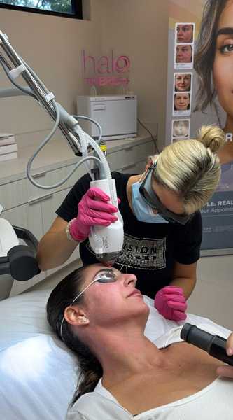 HALO TRIBRID treatment in progress